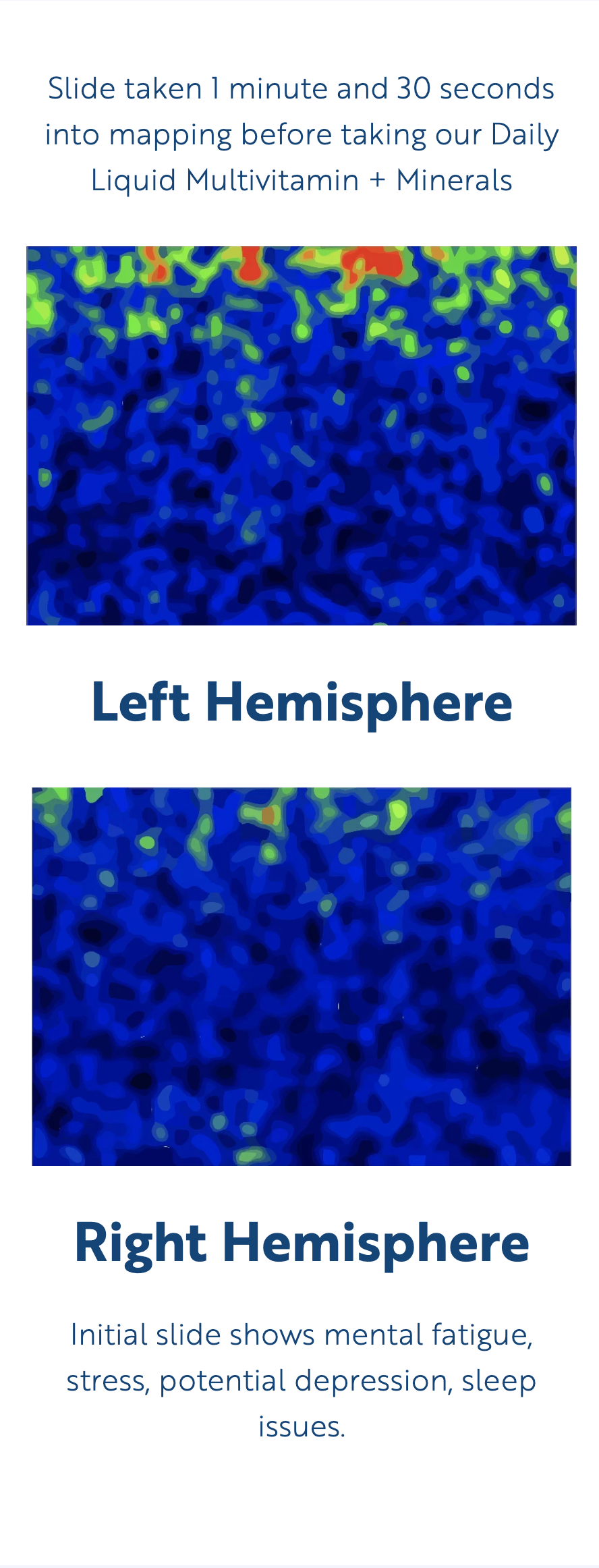 Two images labeled 'Left Hemisphere' and 'Right Hemisphere' with text about mental health issues.