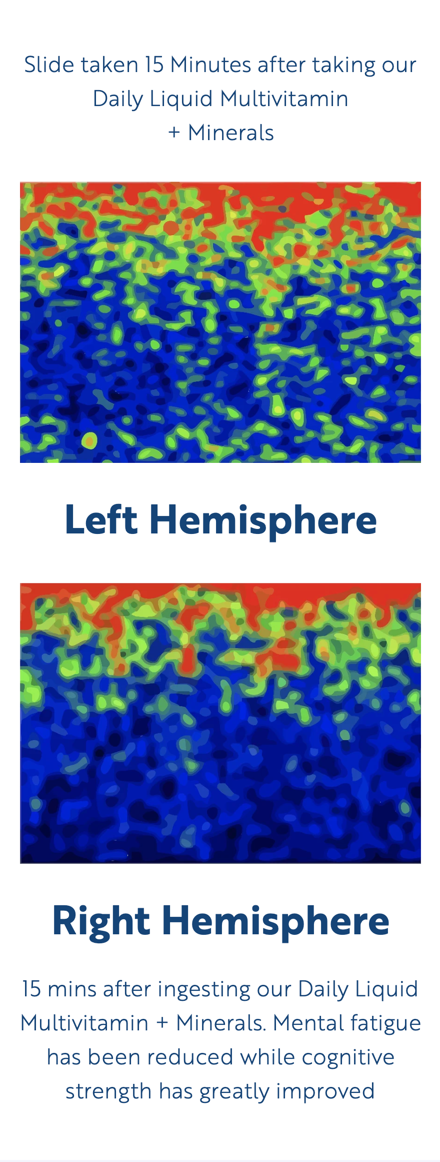 Neuroimaging slide showing left and right hemisphere activity post-multivitamin intake.